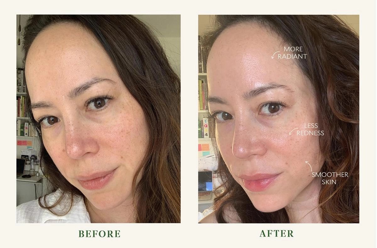 Bio-Barrier Serum