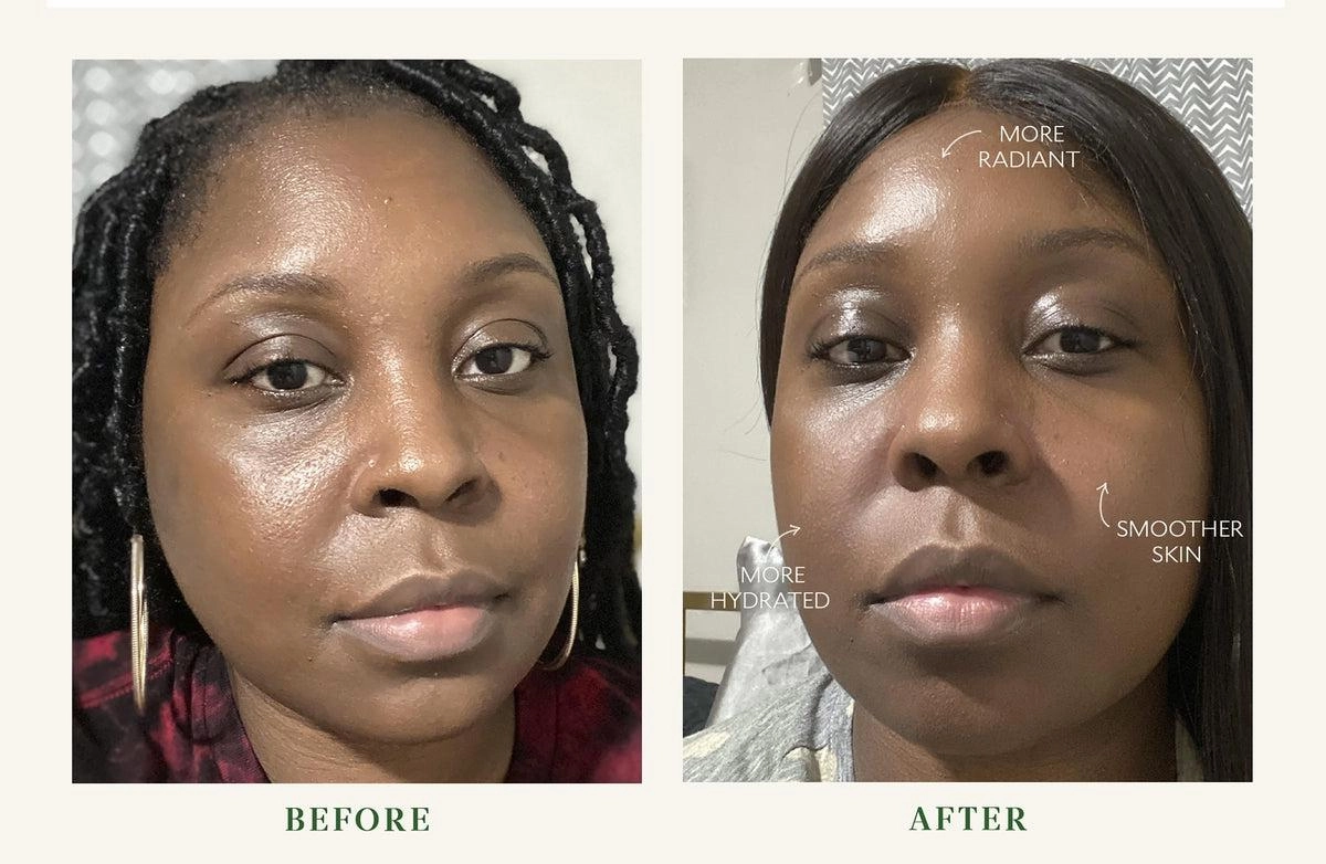 Bio-Barrier Serum