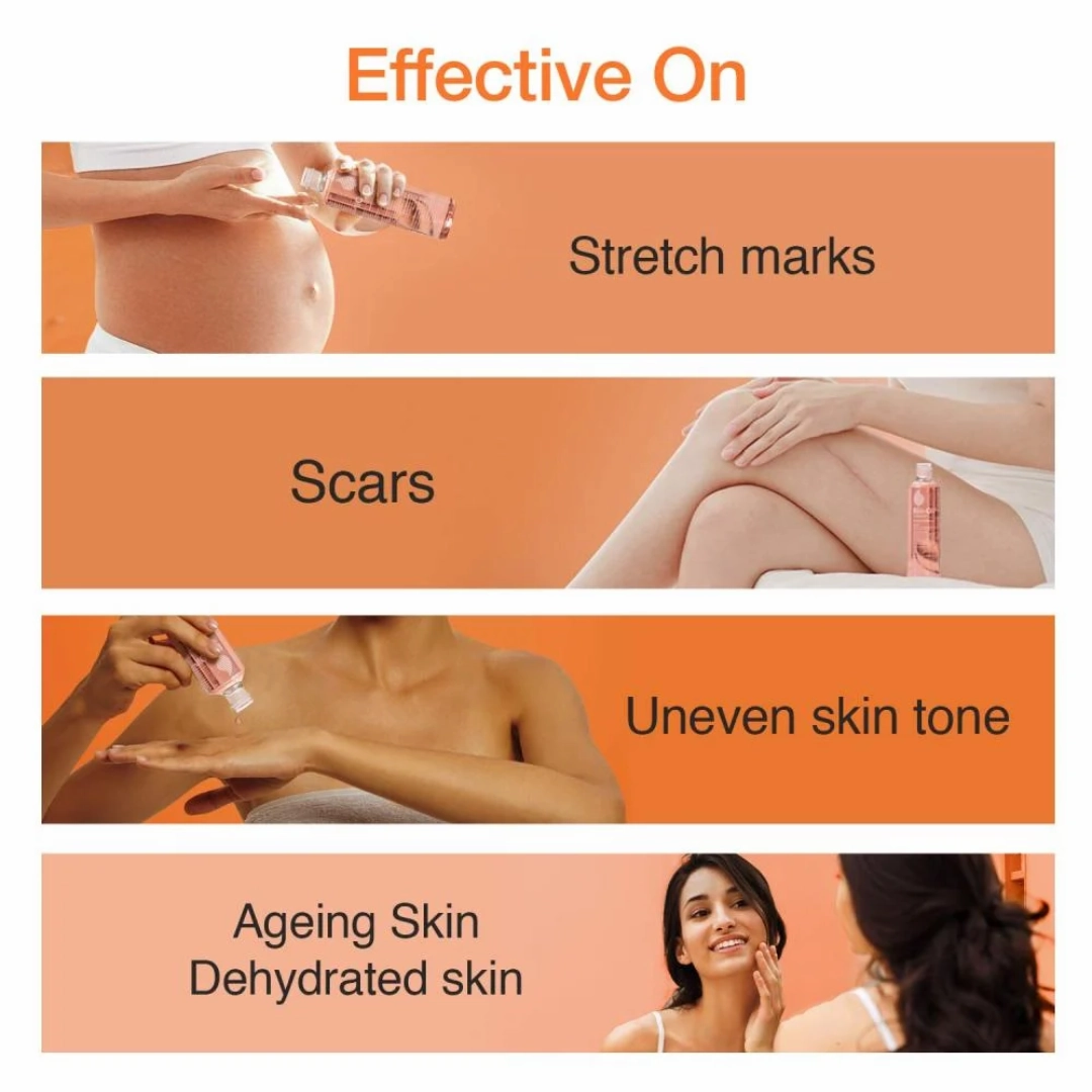 Bio-Oil Skincare Oil: Scars, Stretch marks, Aging and Dehydrated Skin