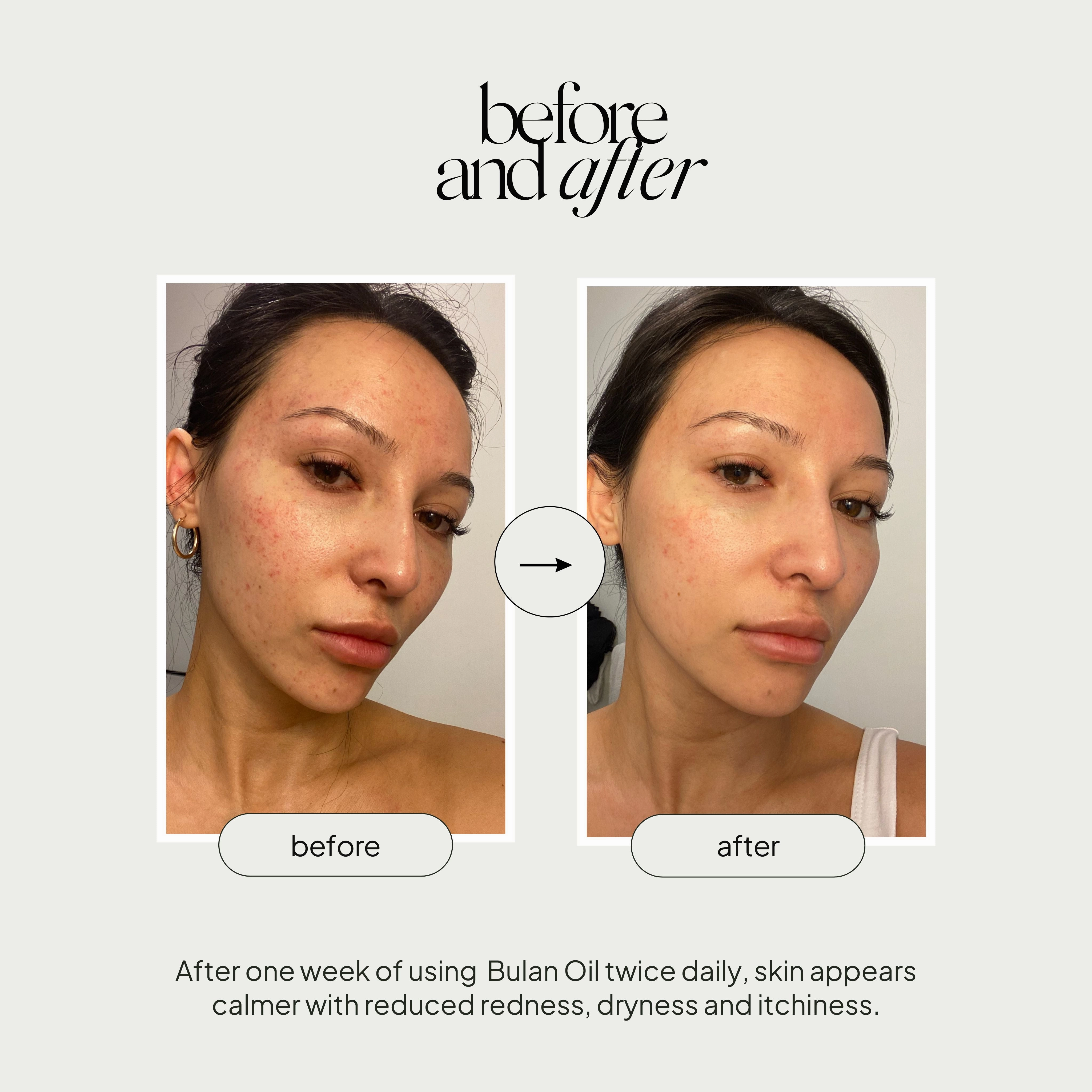 Bulan Nourishing Facial Oil