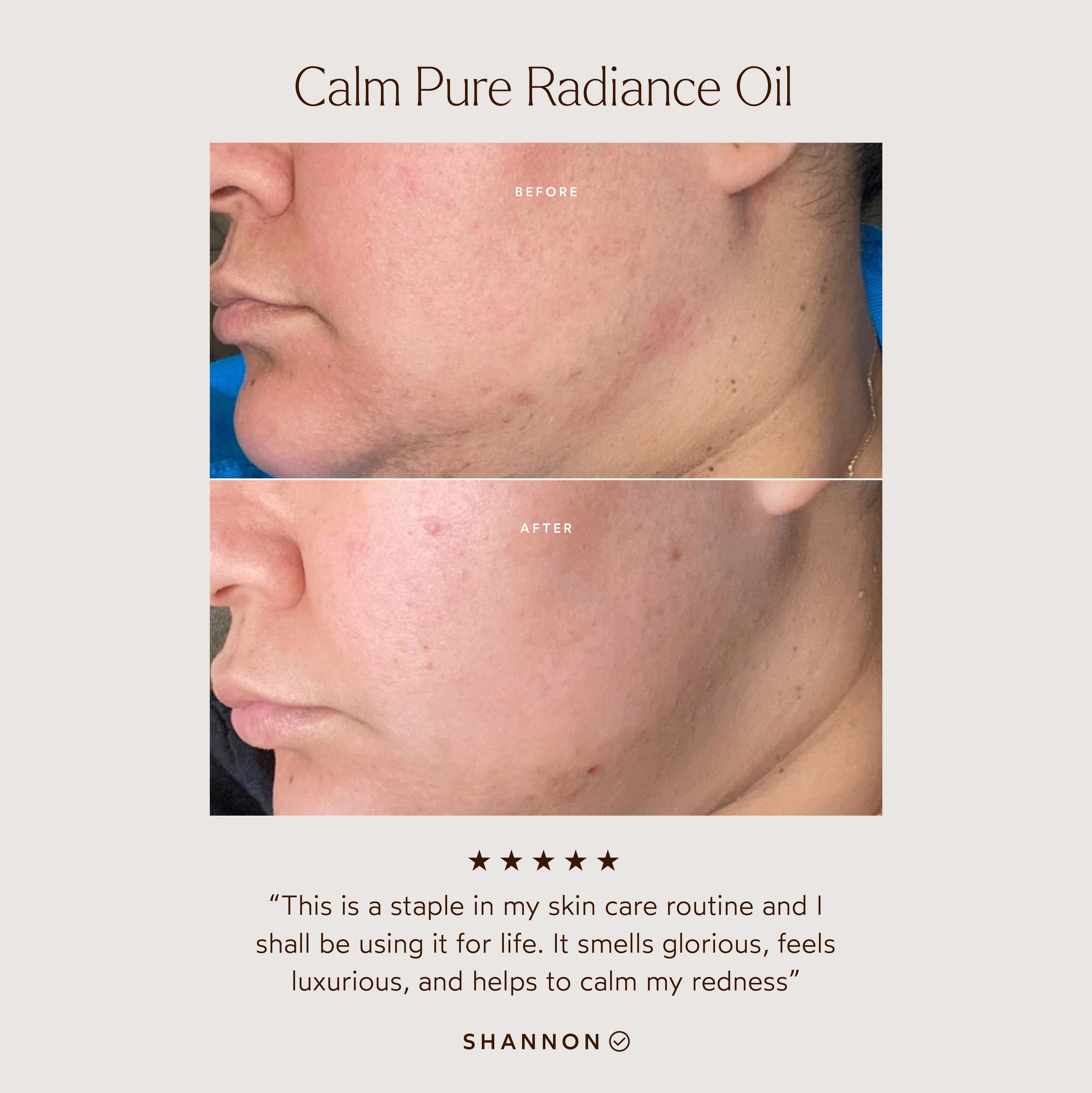 CALM Pure Radiance Oil