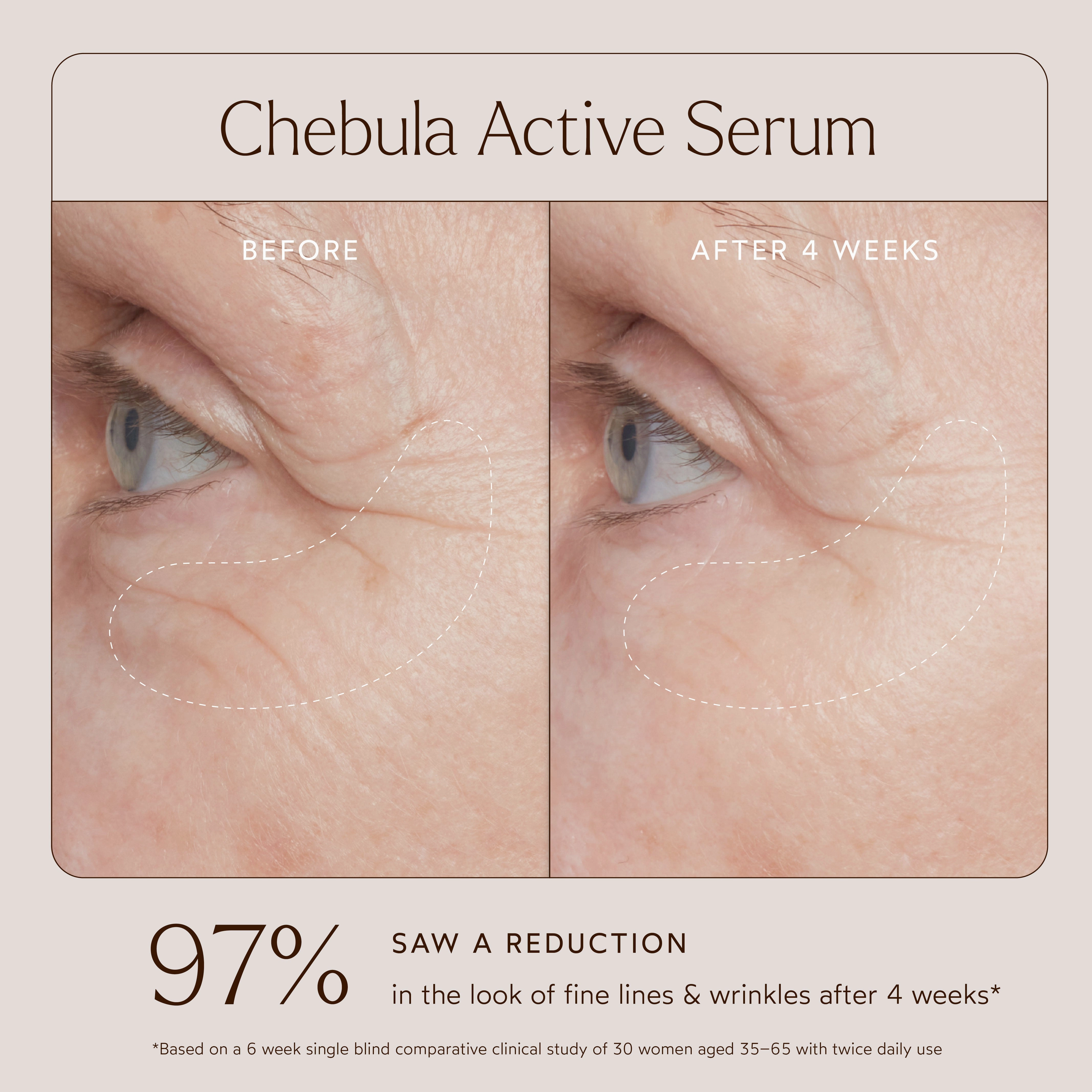 Chebula Active Anti-Aging Serum