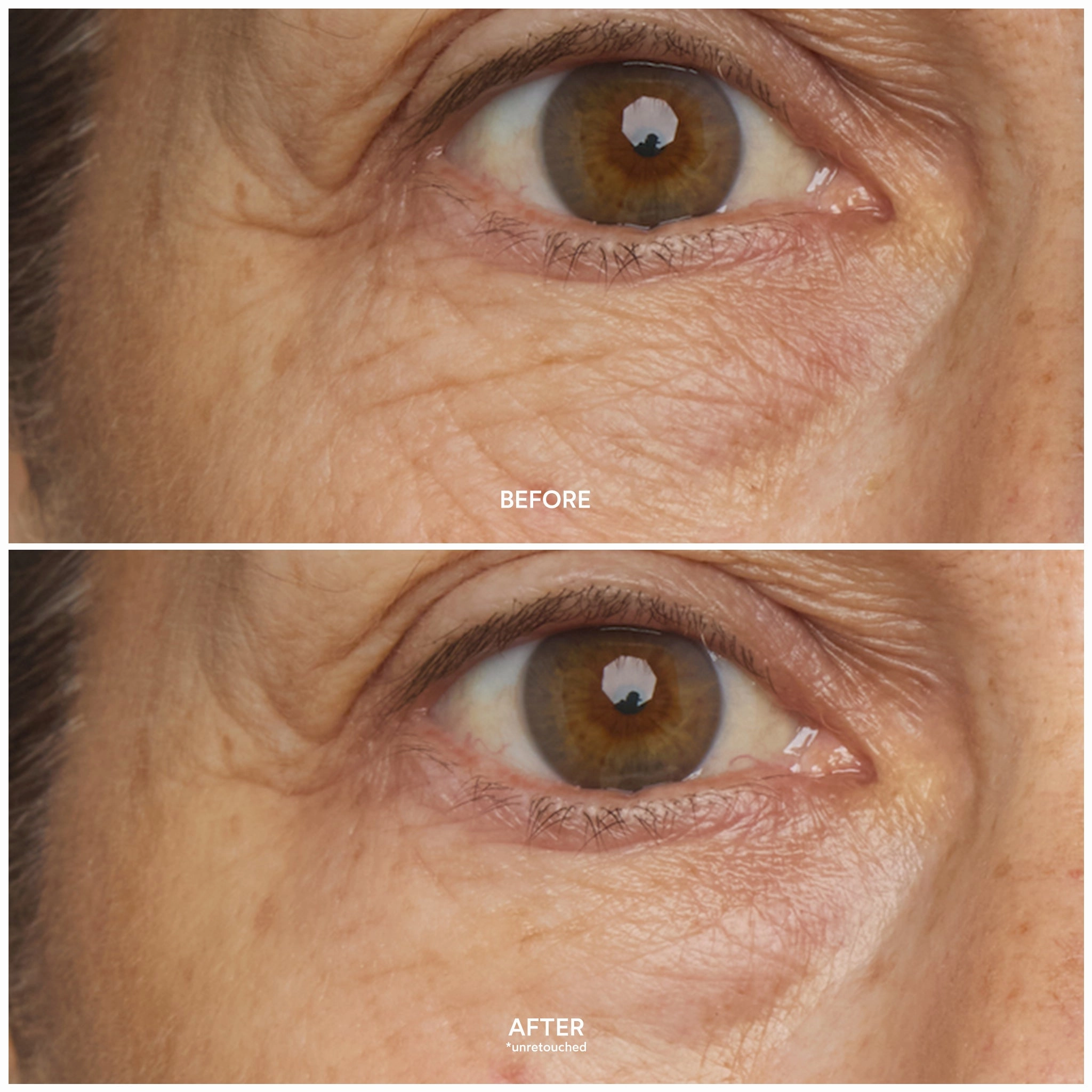 Chebula Multi-Corrective Eye Patches