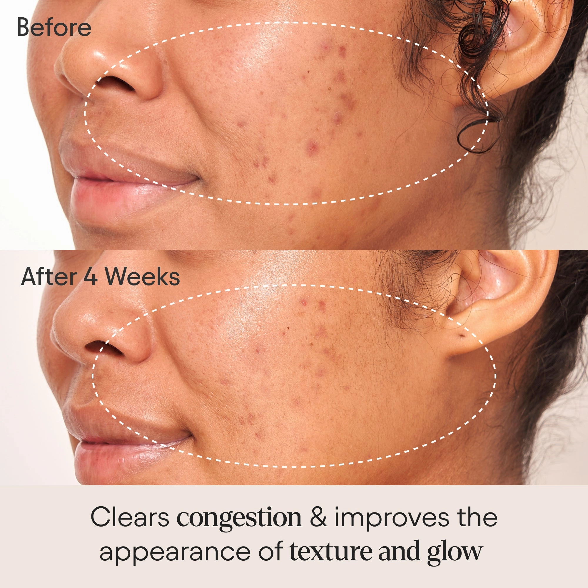 Clarifying Facial Oil With Retinol & Pink Algae