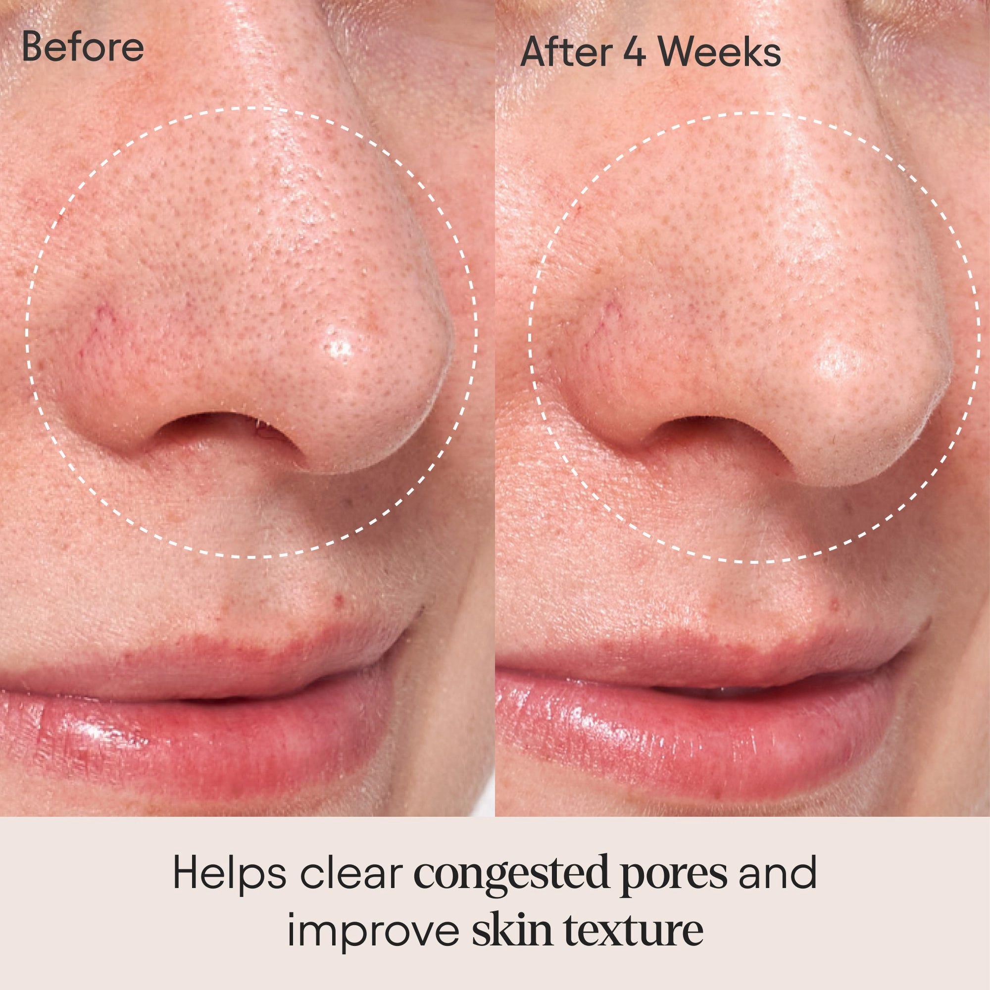 Clarifying Facial Oil With Retinol & Pink Algae