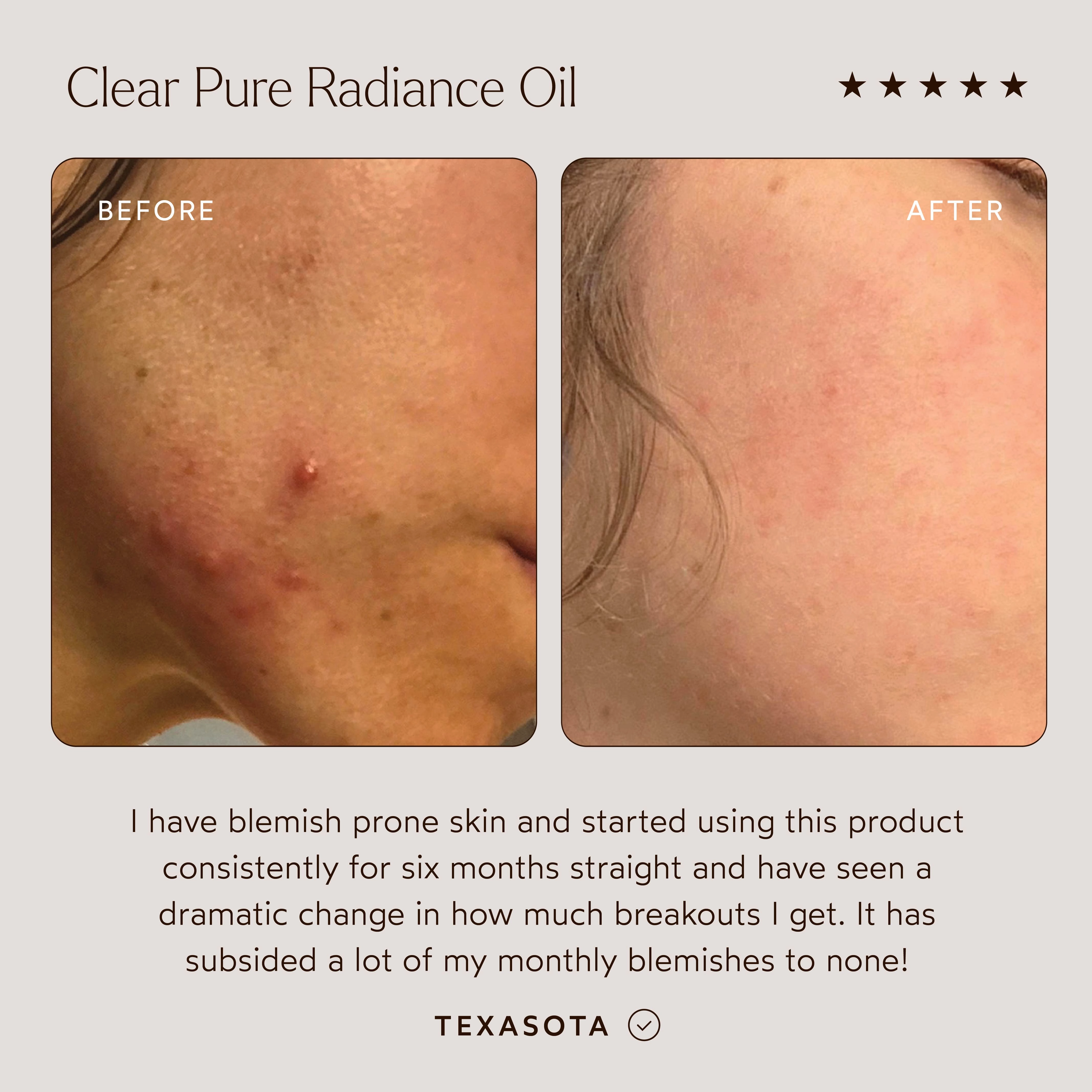CLEAR Pure Radiance Oil