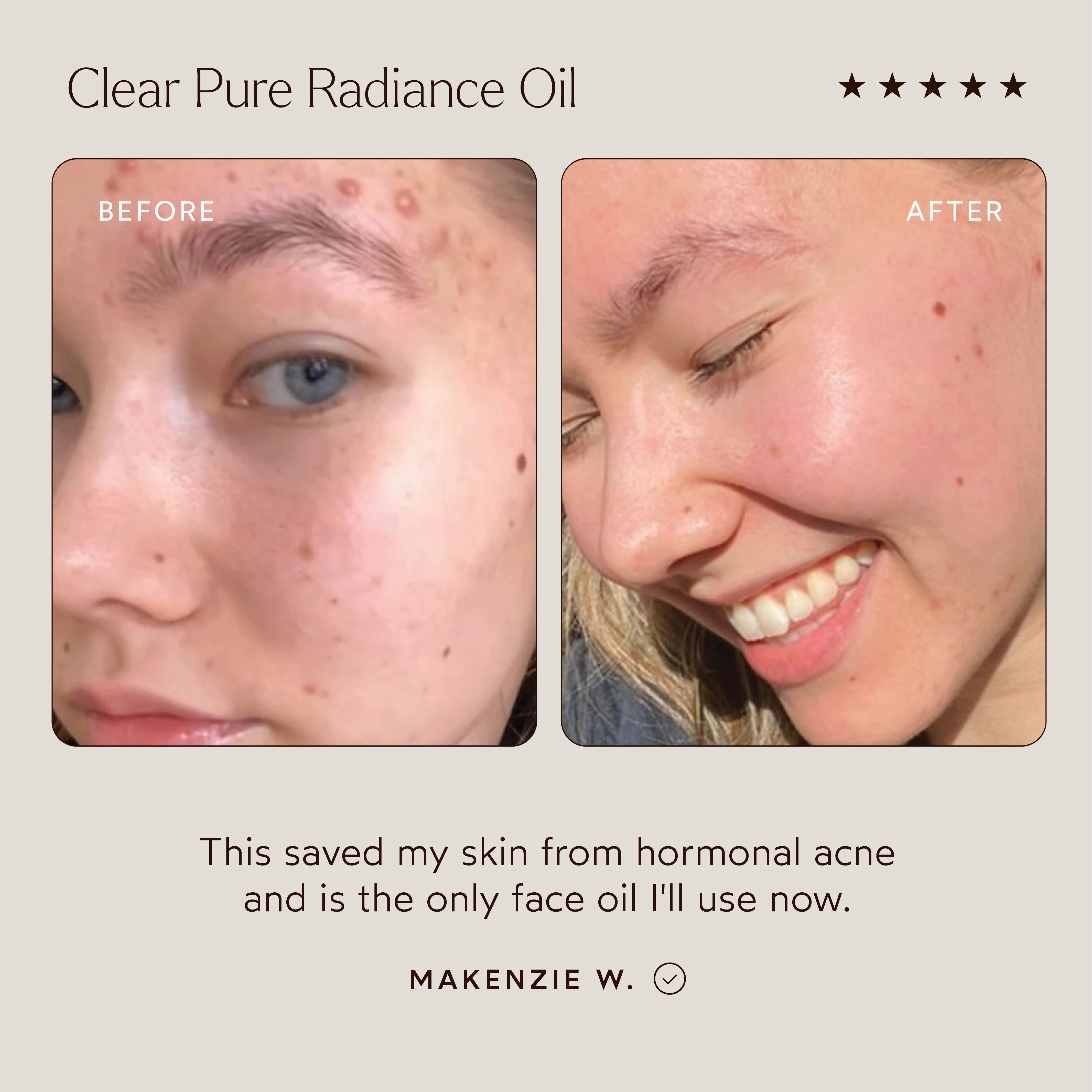 CLEAR Pure Radiance Oil