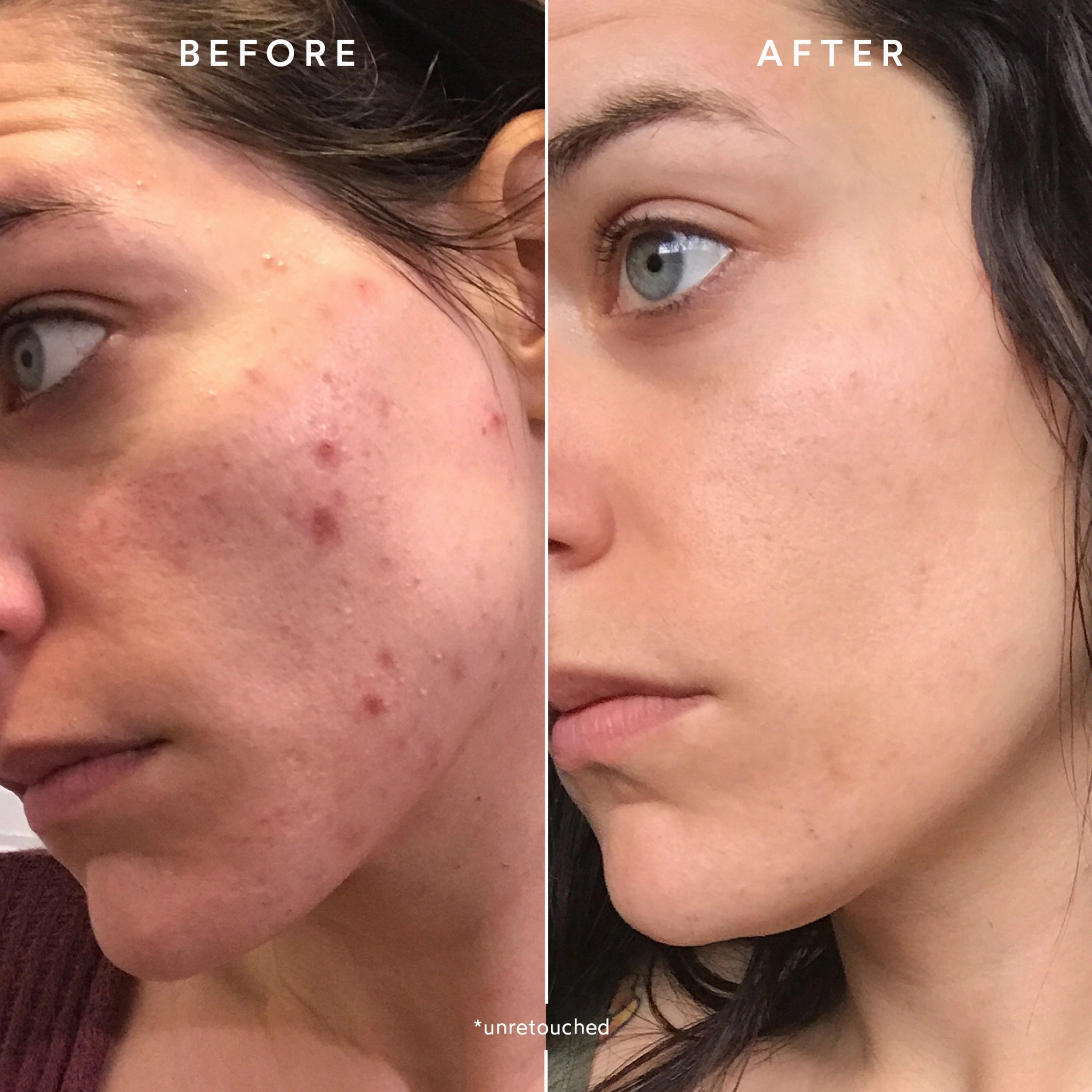 CLEAR Repair Nightly Treatment