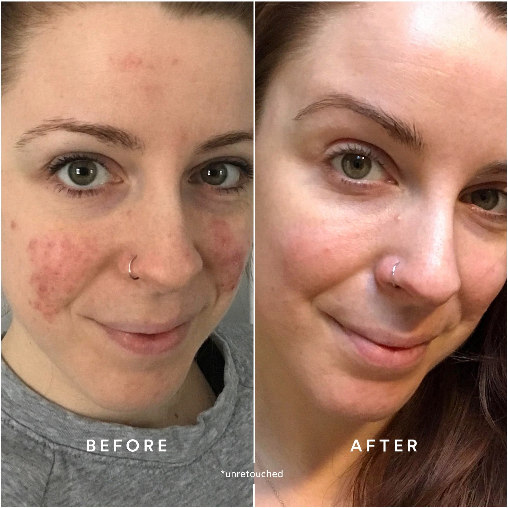 CLEAR Repair Nightly Treatment