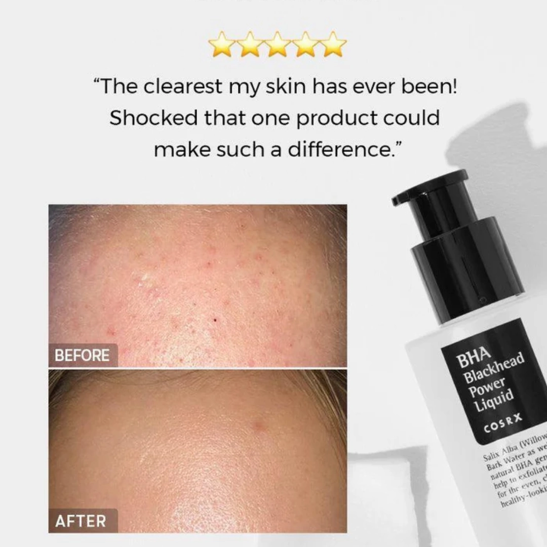 Cosrx Bha Blackhead Power Liquid