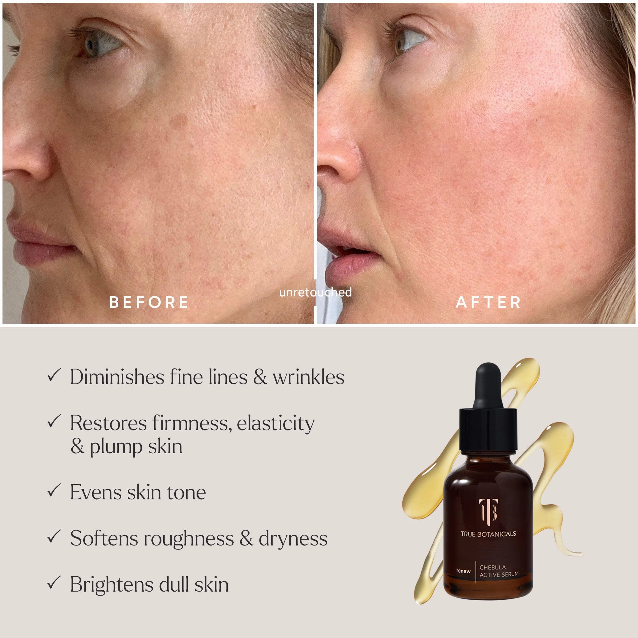 Deep Hydration Renewal?C3 Piece Daily Essentials