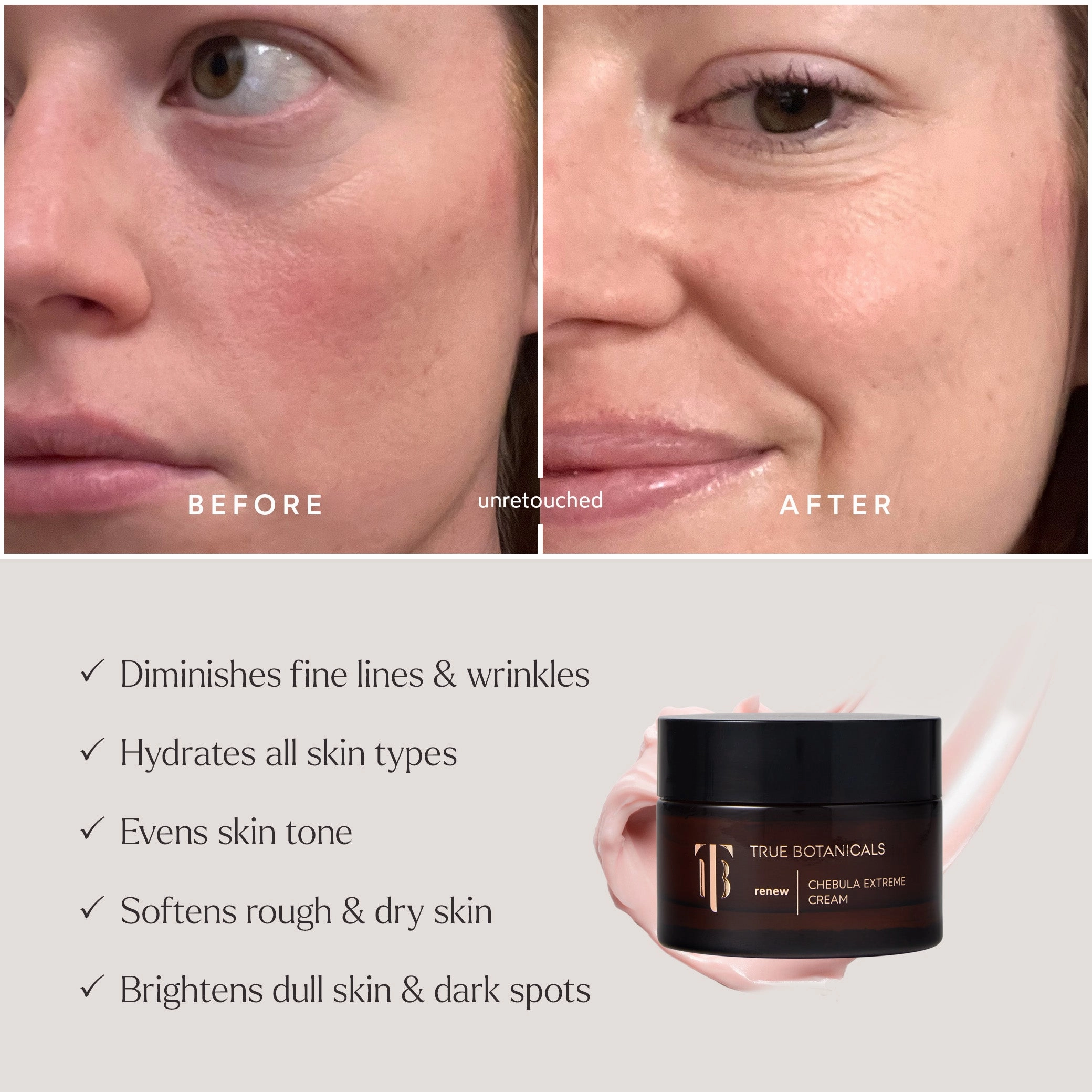 Deep Hydration Renewal?C3 Piece Daily Essentials