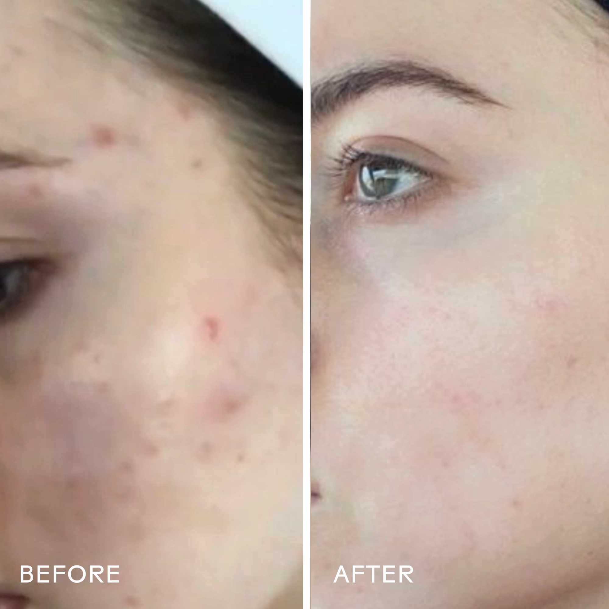 Dew Drops Mushroom   Kakadu Plum Hyaluronic Acid Serum