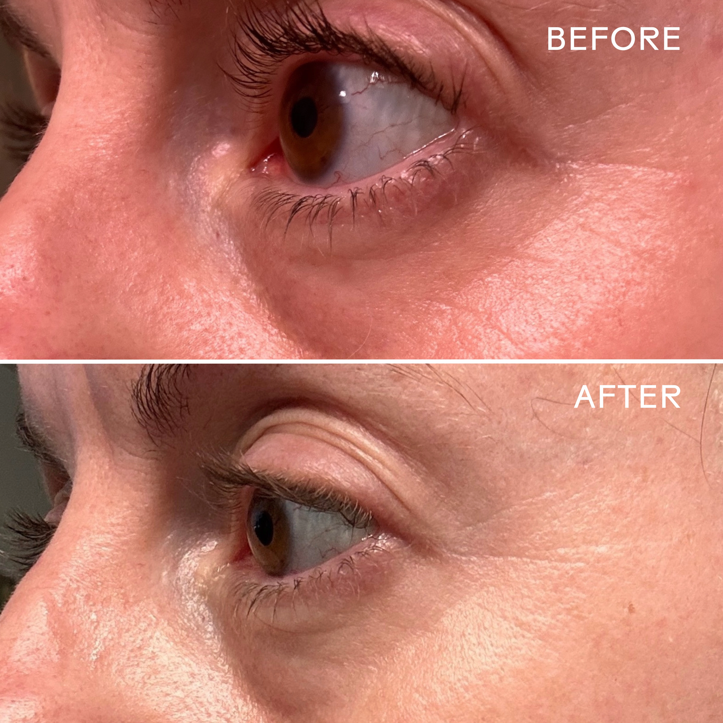 EyeHero? Bio-Retinol Smoothing Eye Cream