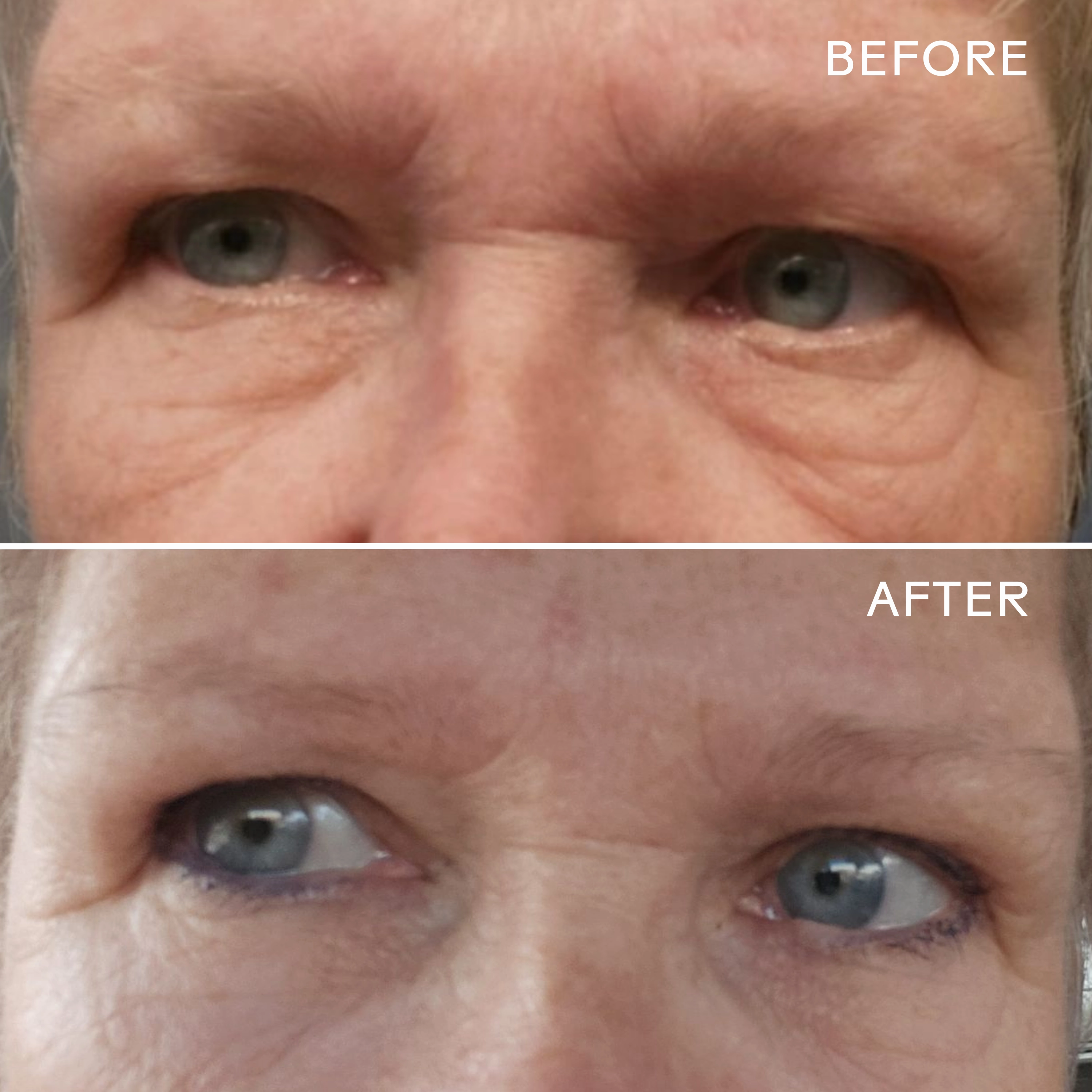 EyeHero? Bio-Retinol Smoothing Eye Cream