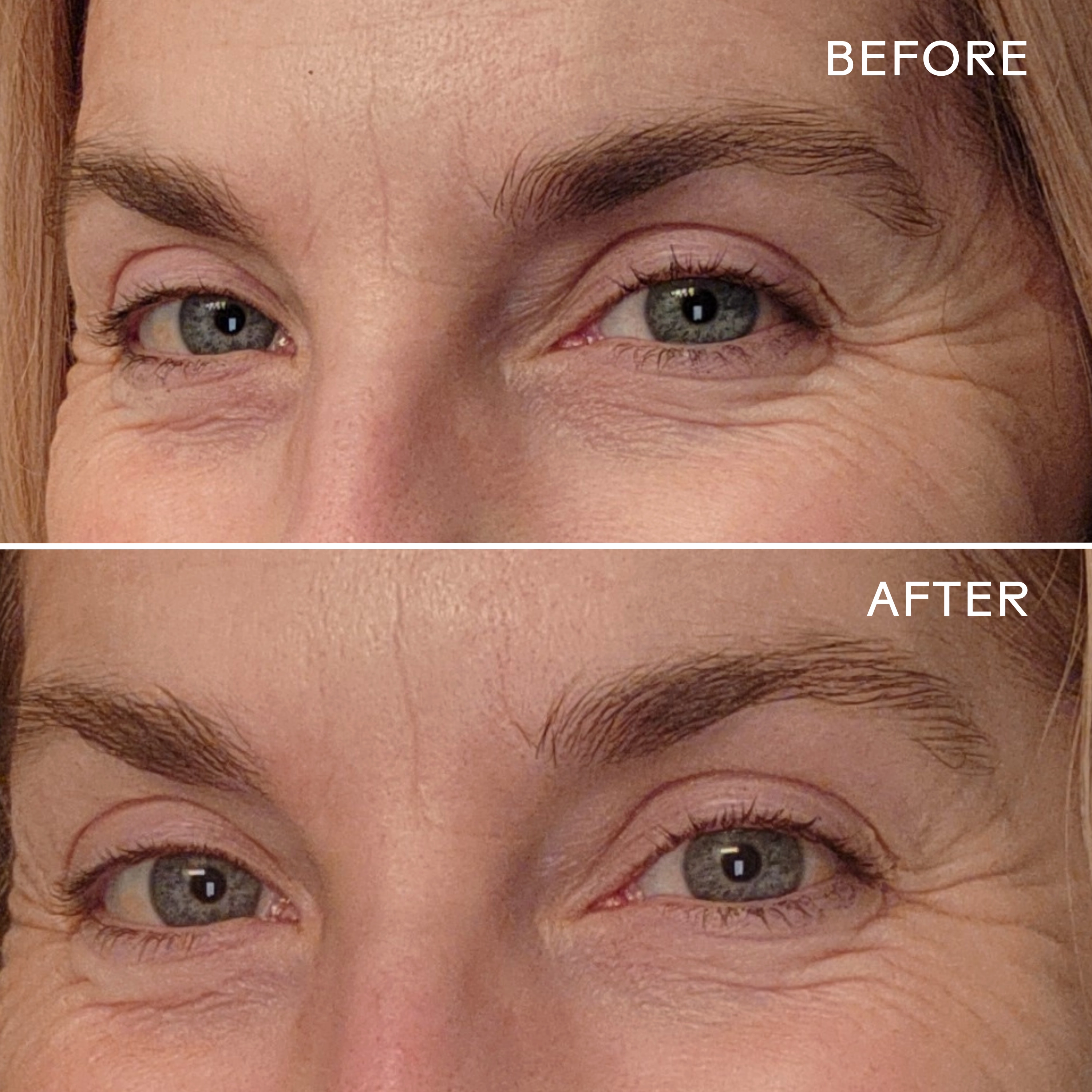 EyeHero? Bio-Retinol Smoothing Eye Cream