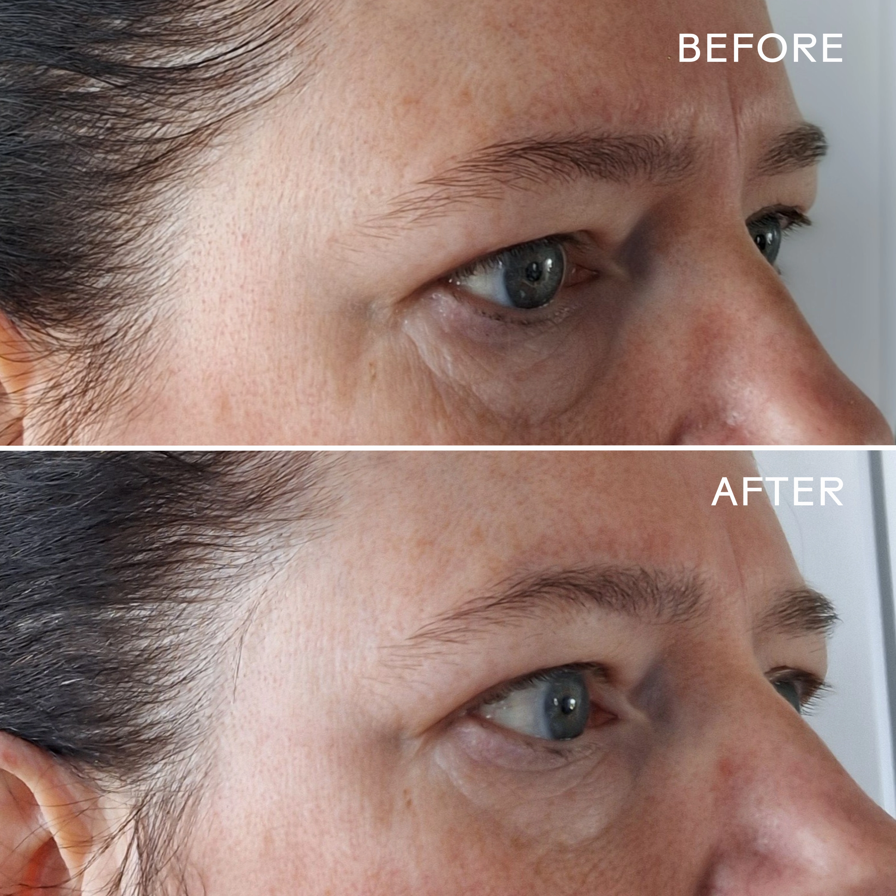 EyeHero? Bio-Retinol Smoothing Eye Cream