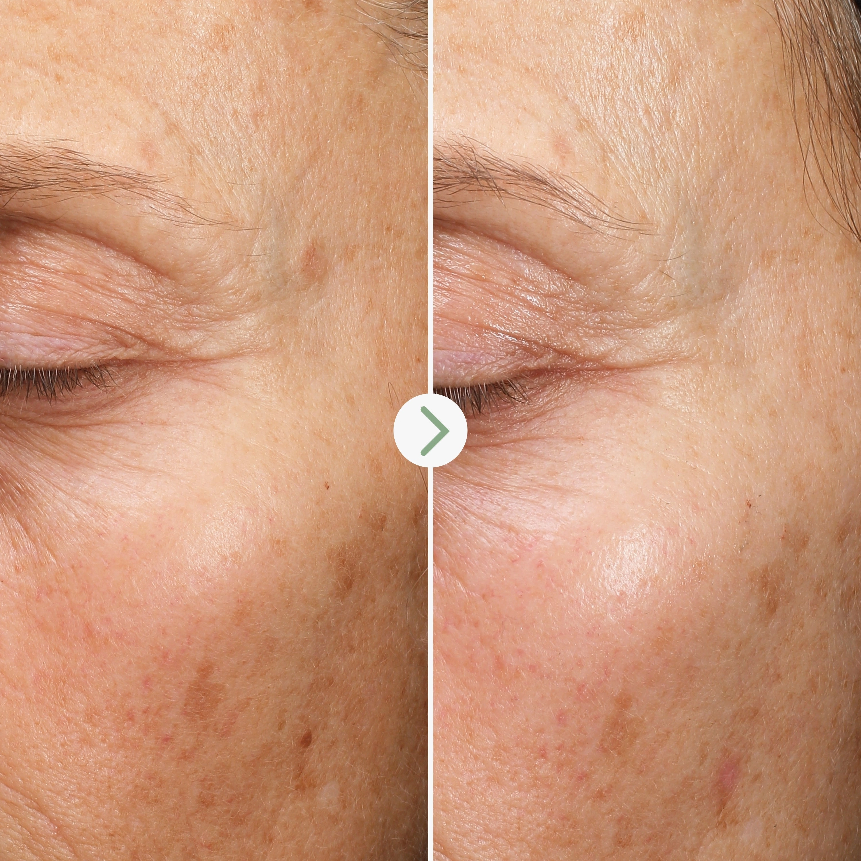 Fade Forward Dark Spot Serum