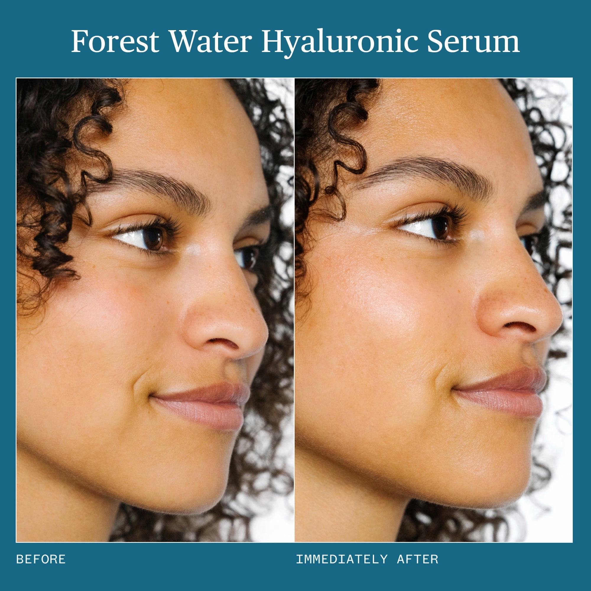 Forest Water Hyaluronic Serum