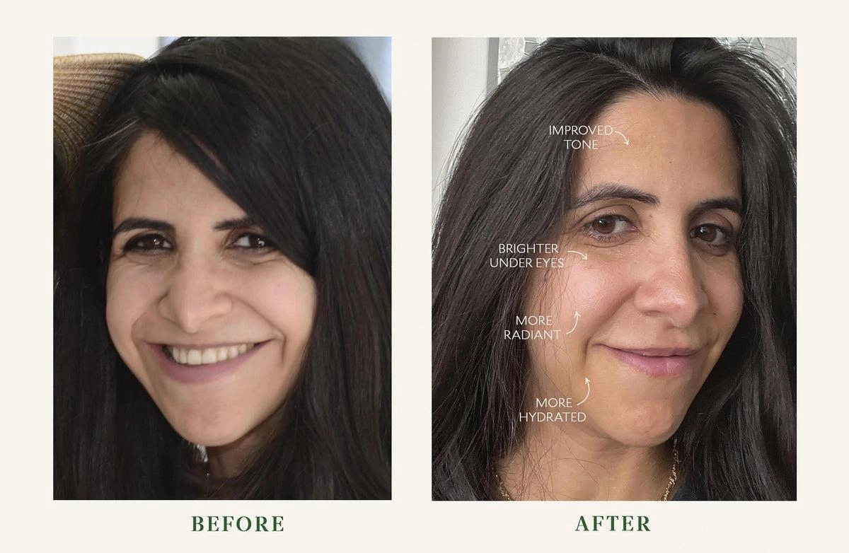 Fortifying Moisturizer