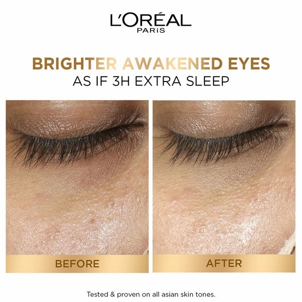 Glycolic [3% Glycolic Acid    Vitamin CG   Niacinamide] Eye Serum For Dark Circles, Brighten Eyes 20