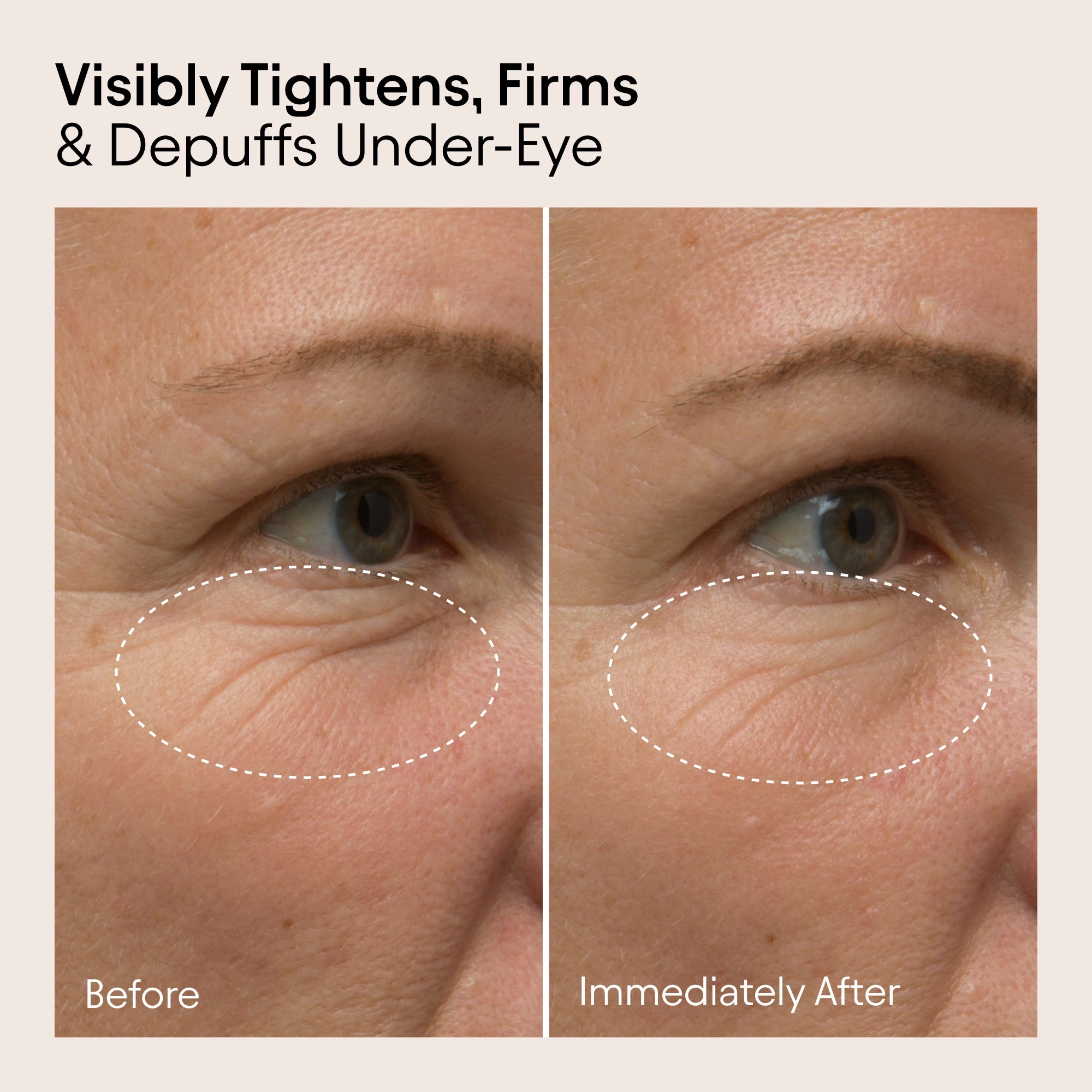 Line-Filling Eye Balm