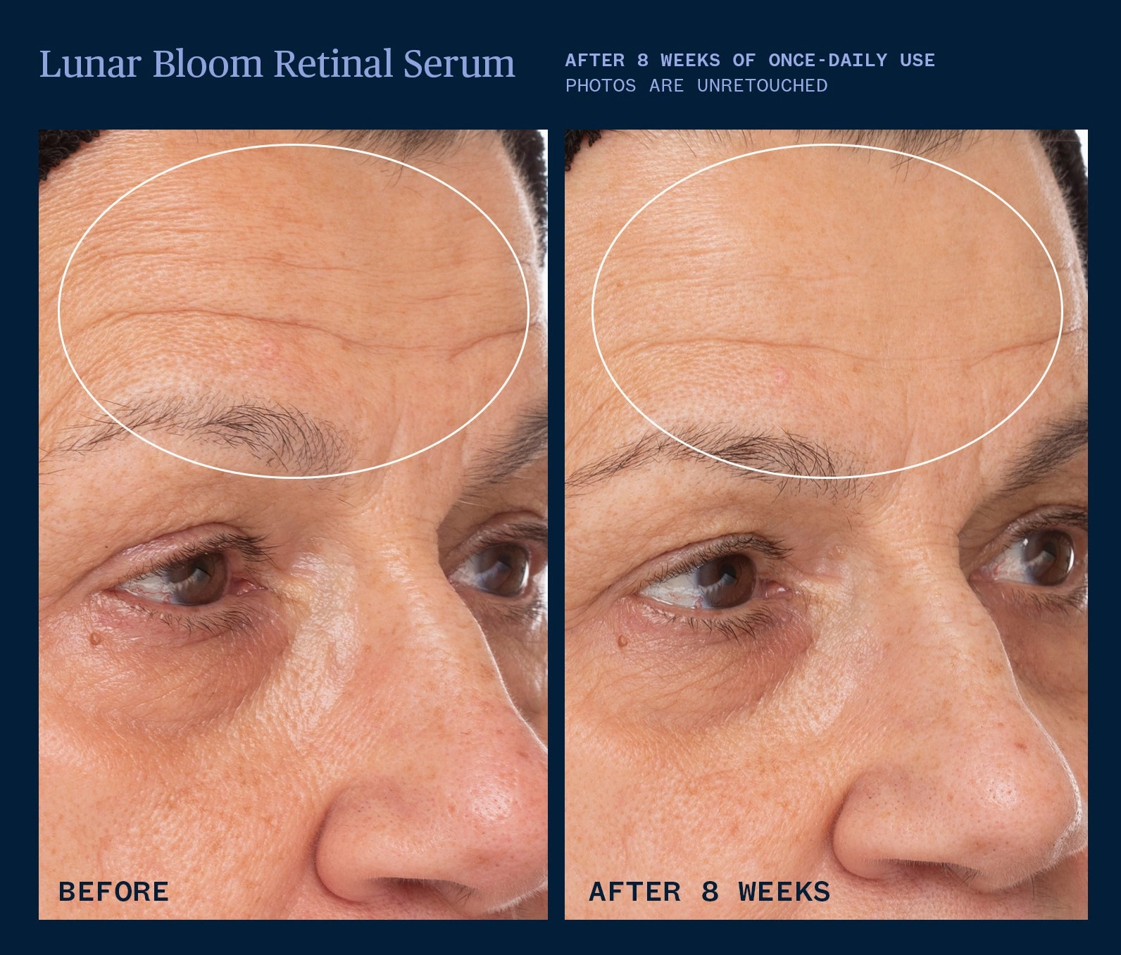 Lunar Bloom Retinal Serum