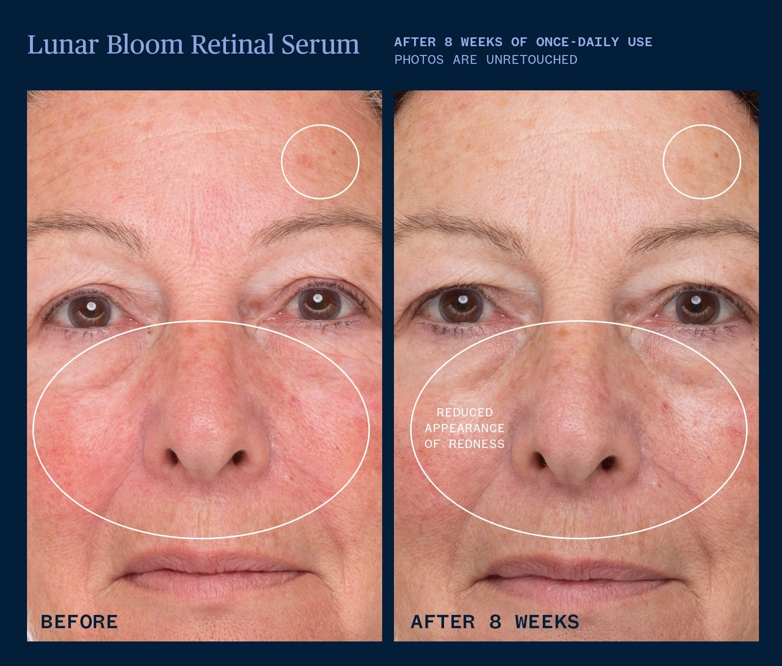 Lunar Bloom Retinal Serum