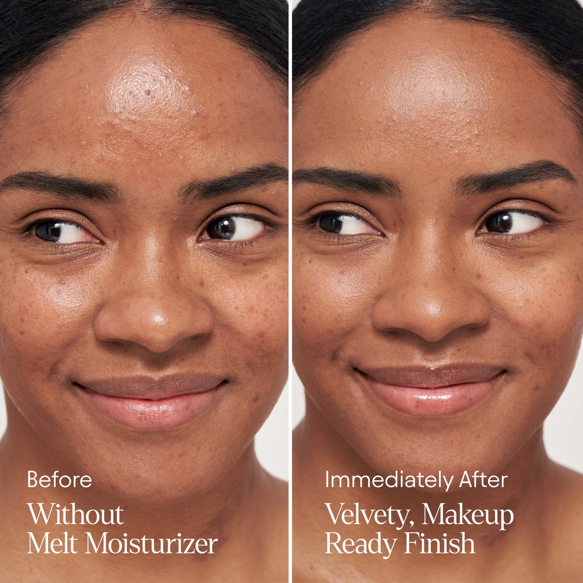 Melt Moisturizer
