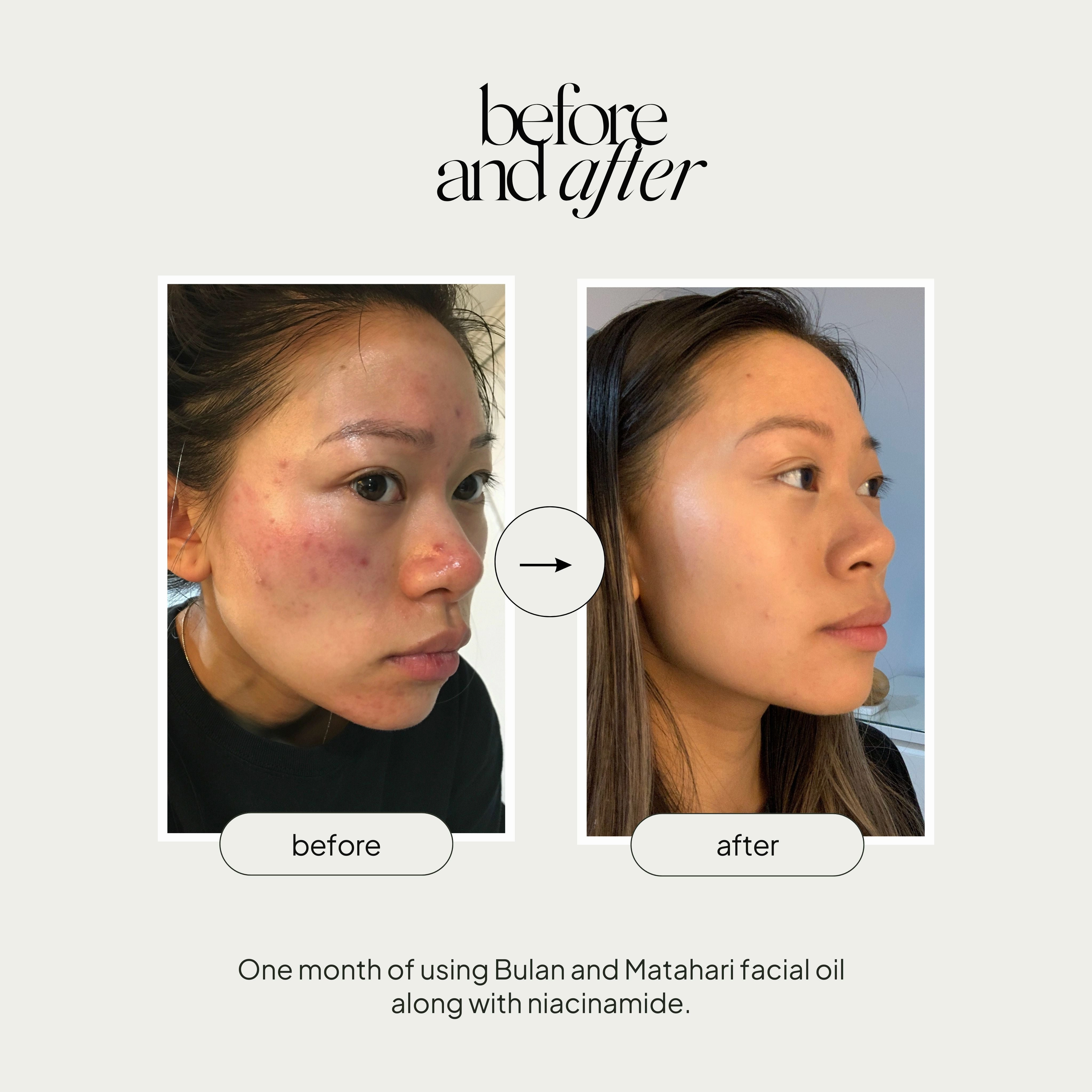 Mini Facial Oil Duo Set
