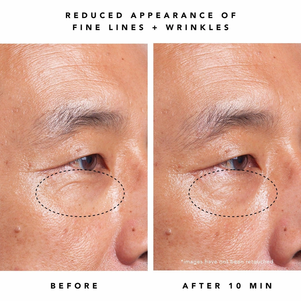 Moon Dew 1% Bakuchiol   Peptides Retinol Alternative Eye Cream