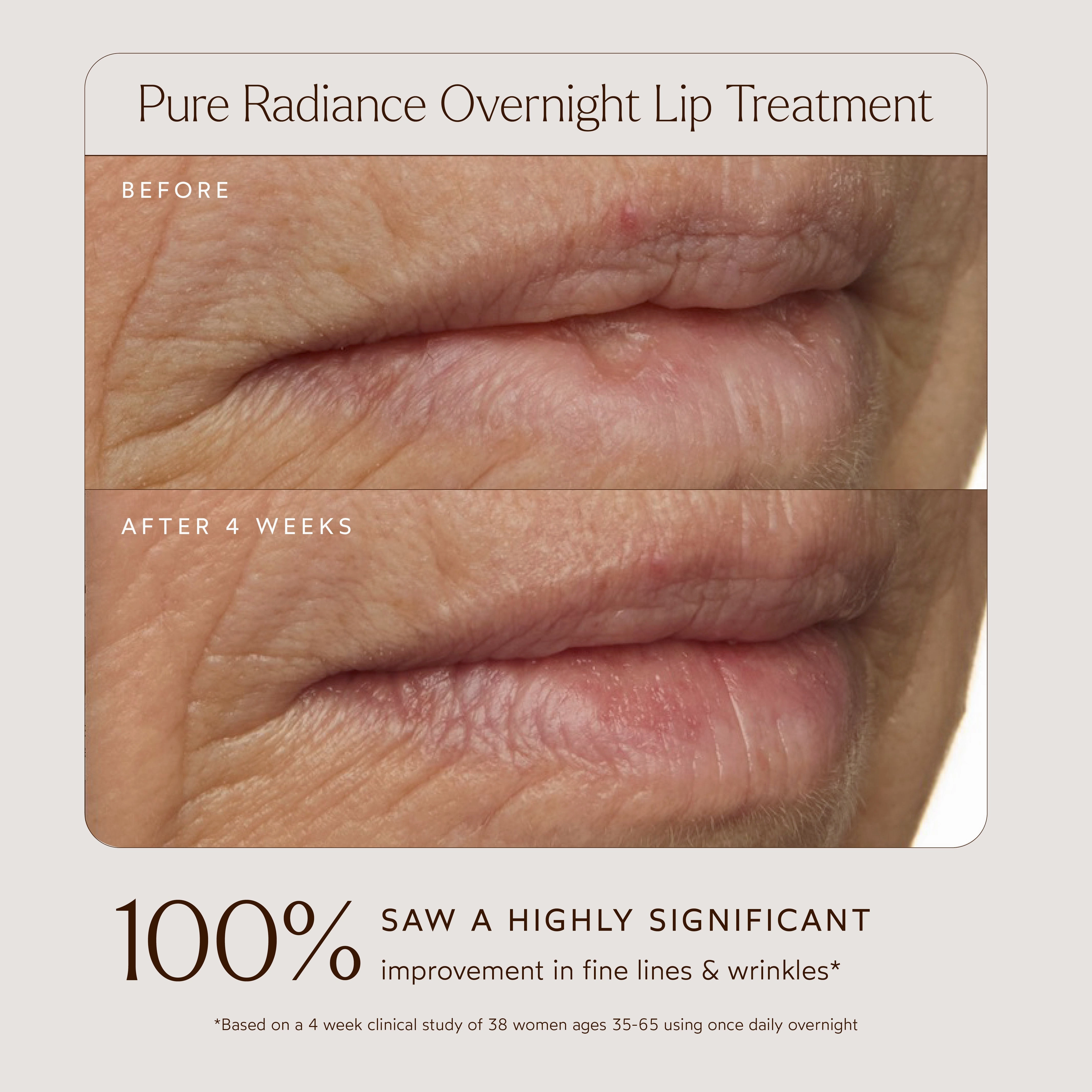 Pure Radiance Overnight Lip Treatment