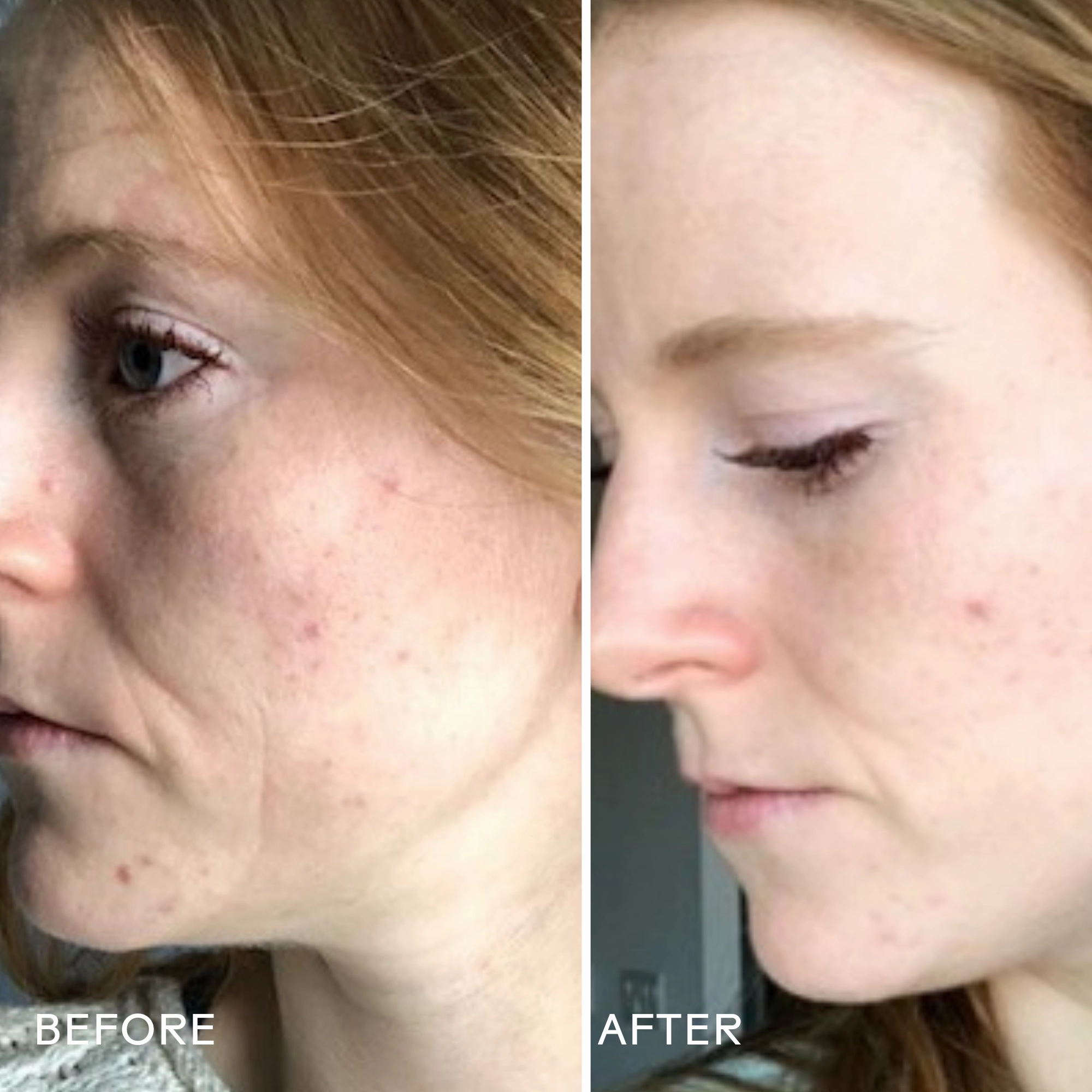 Refresh Papaya   Salicylic Acid Cleanser