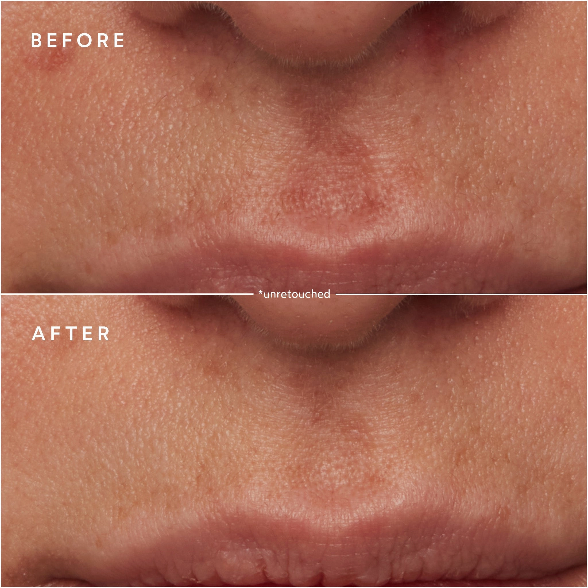 Renew Microbiome Enzyme Essence
