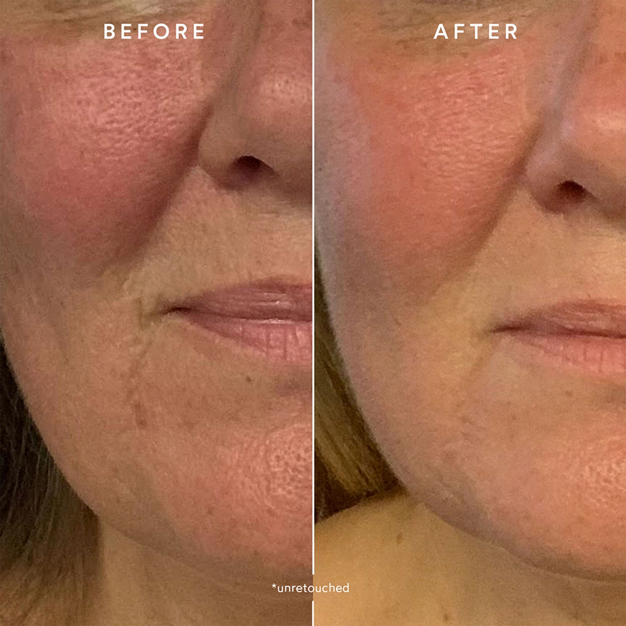 RENEW Repair Nightly Treatment