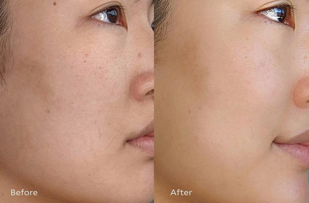 Resurfacing Serum