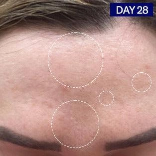 Salicylic   Hyaluronic Acid Clarifying Serum