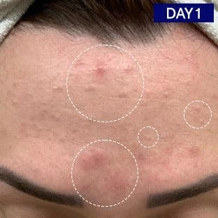 Salicylic   Hyaluronic Acid Clarifying Serum