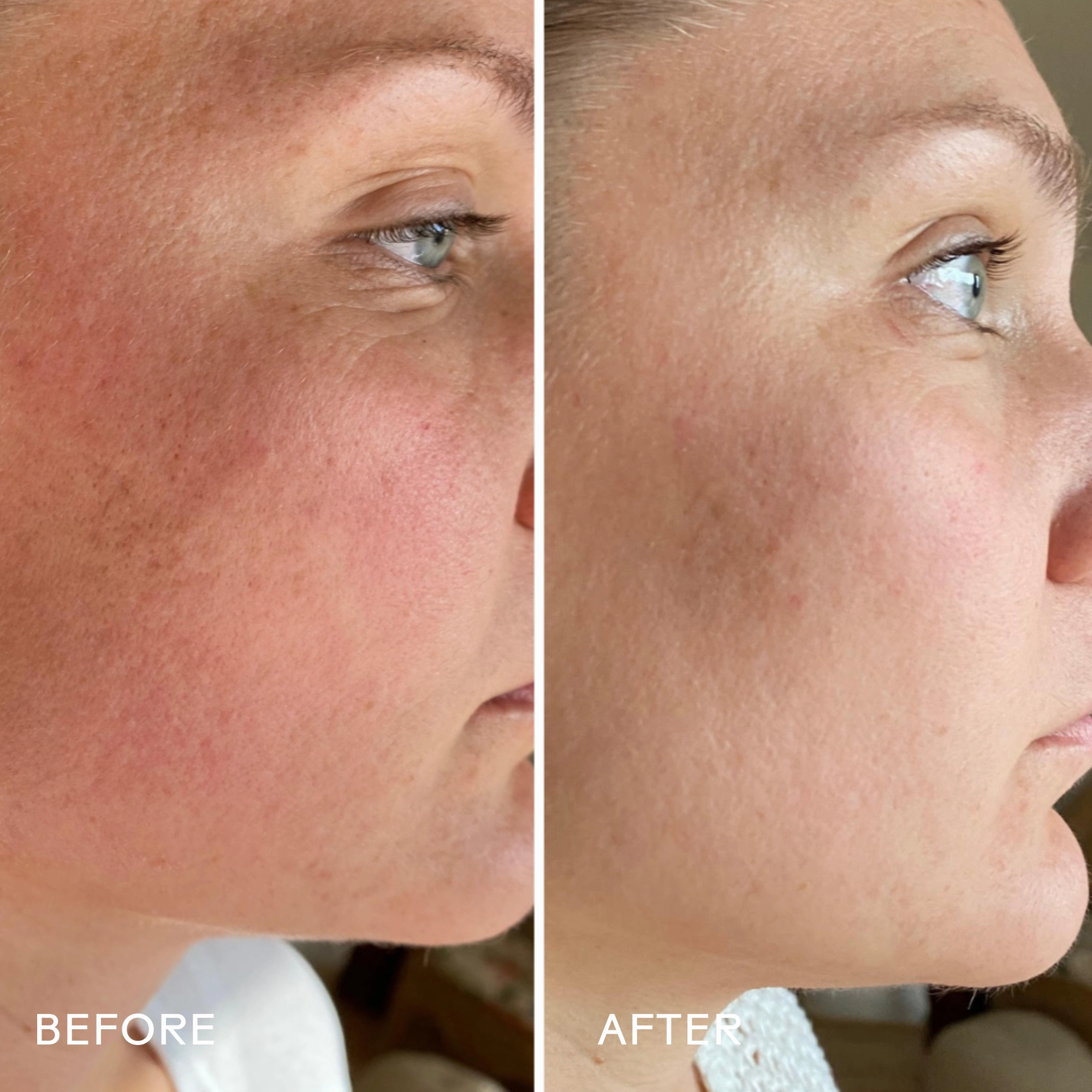 SkinHero? Calendula   2% Bakuchiol Bio-Retinol Serum