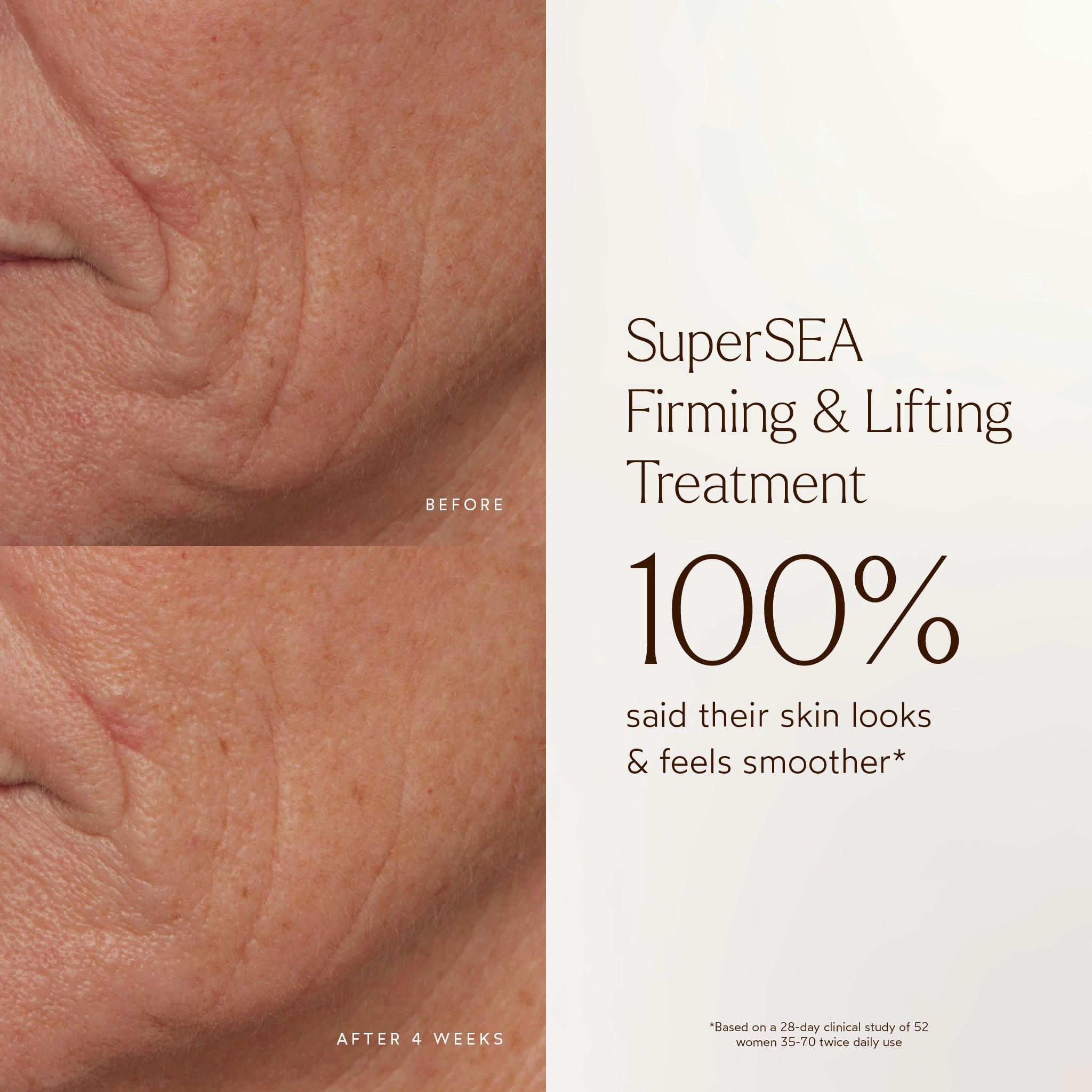 SuperSEA Firming & Lifting Serum