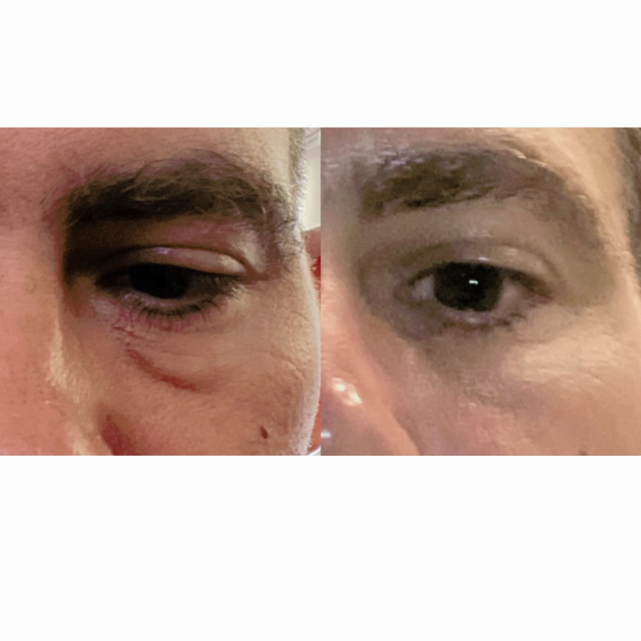 The Advanced Eye Response Complex