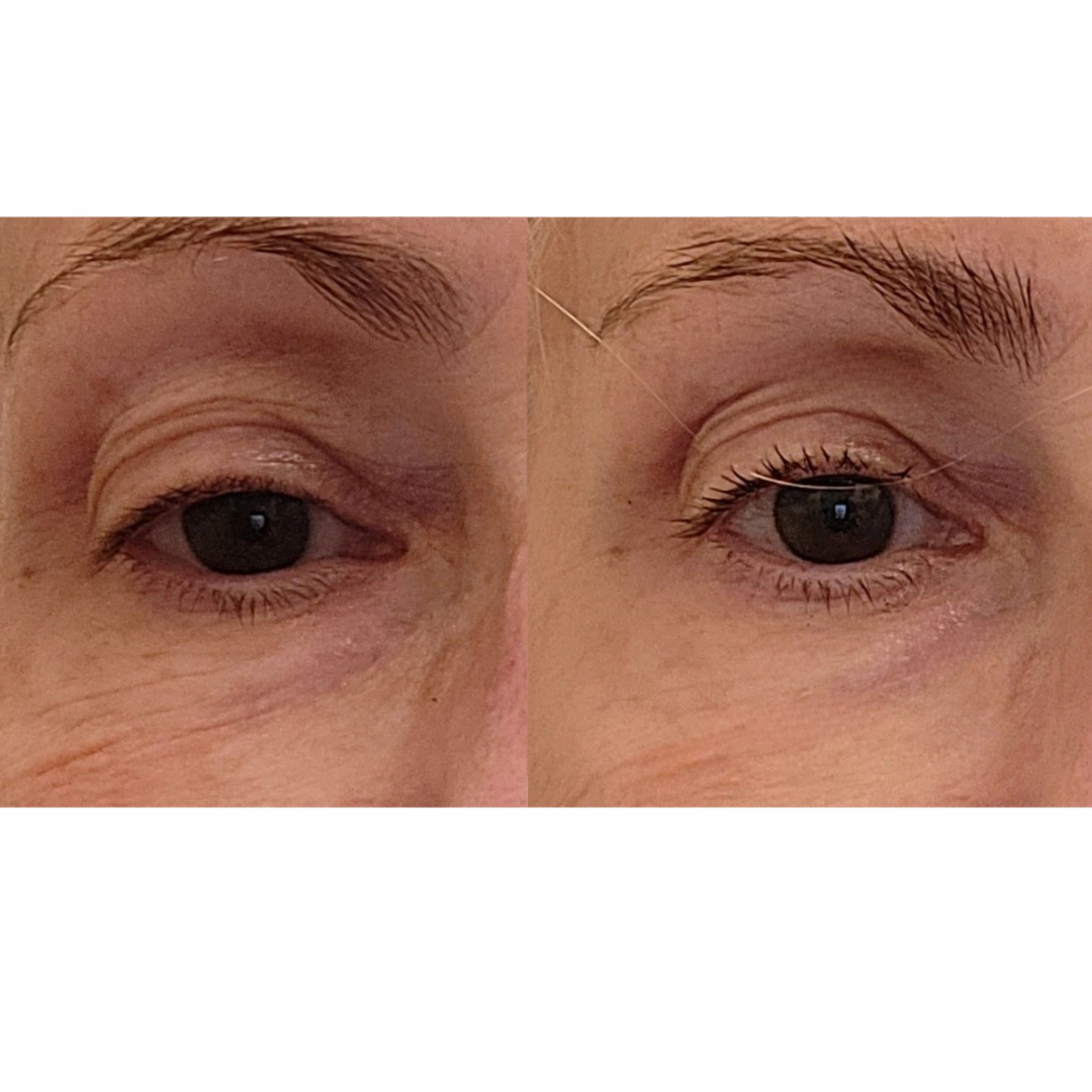 The Advanced Eye Response Complex