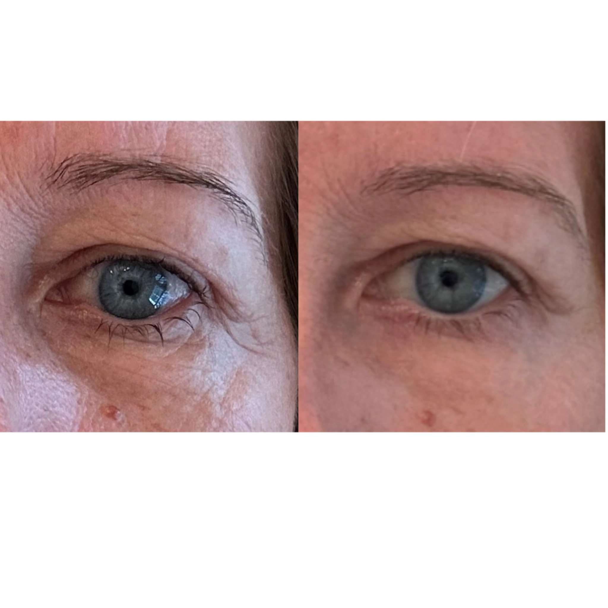 The Advanced Eye Response Complex