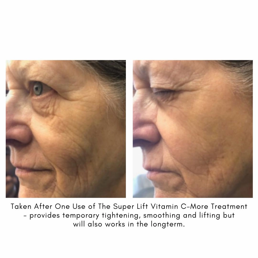 The Super Lift Vitamin C-More Treatment