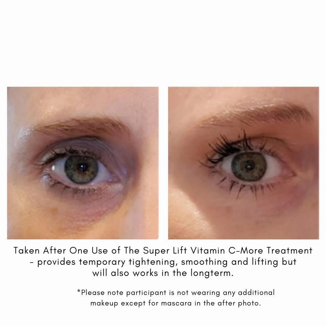 The Super Lift Vitamin C-More Treatment
