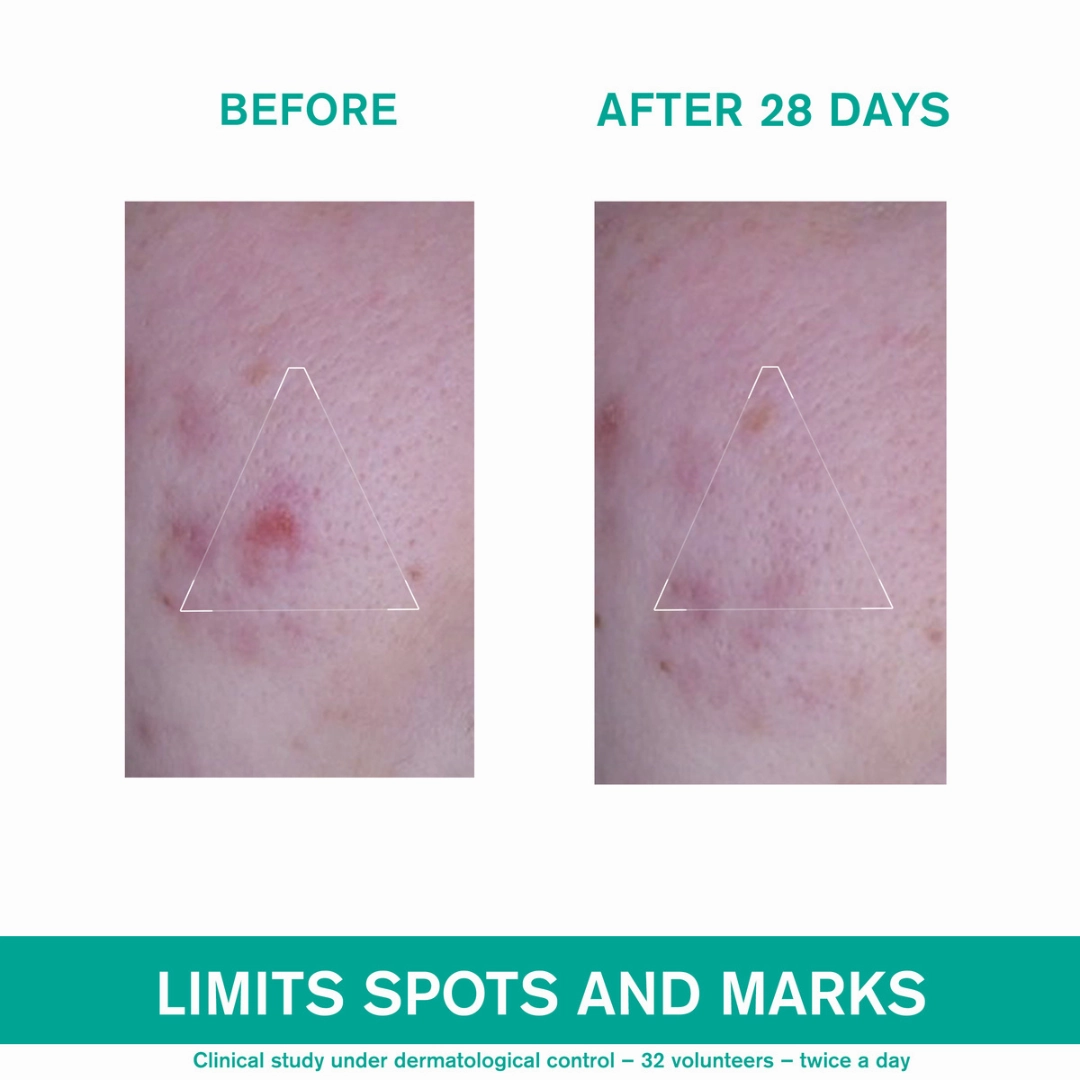 Uriage Hysac 3-Regul   Anti-Blemish Global Care 40 ml