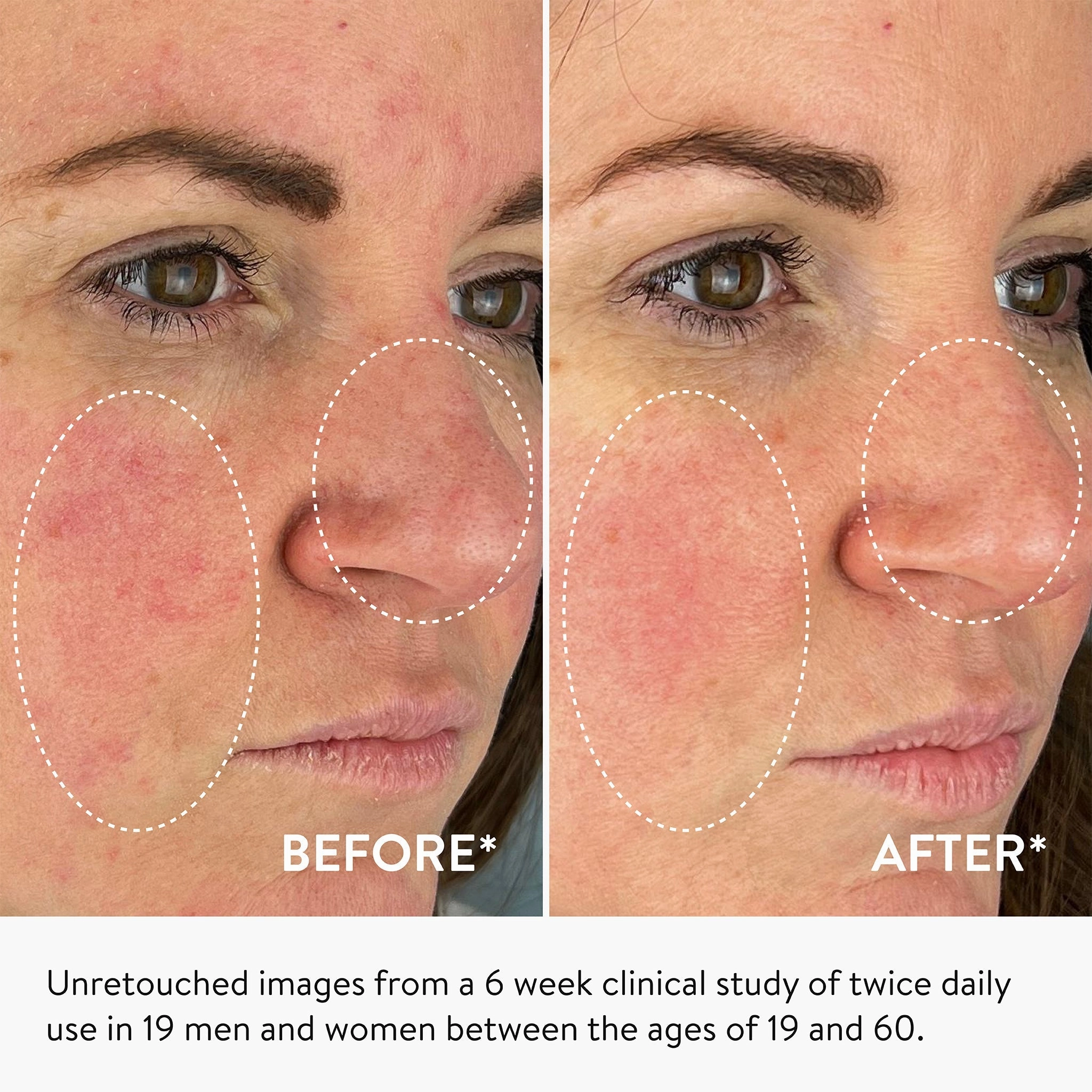 Youth-Boost Peptide Serum